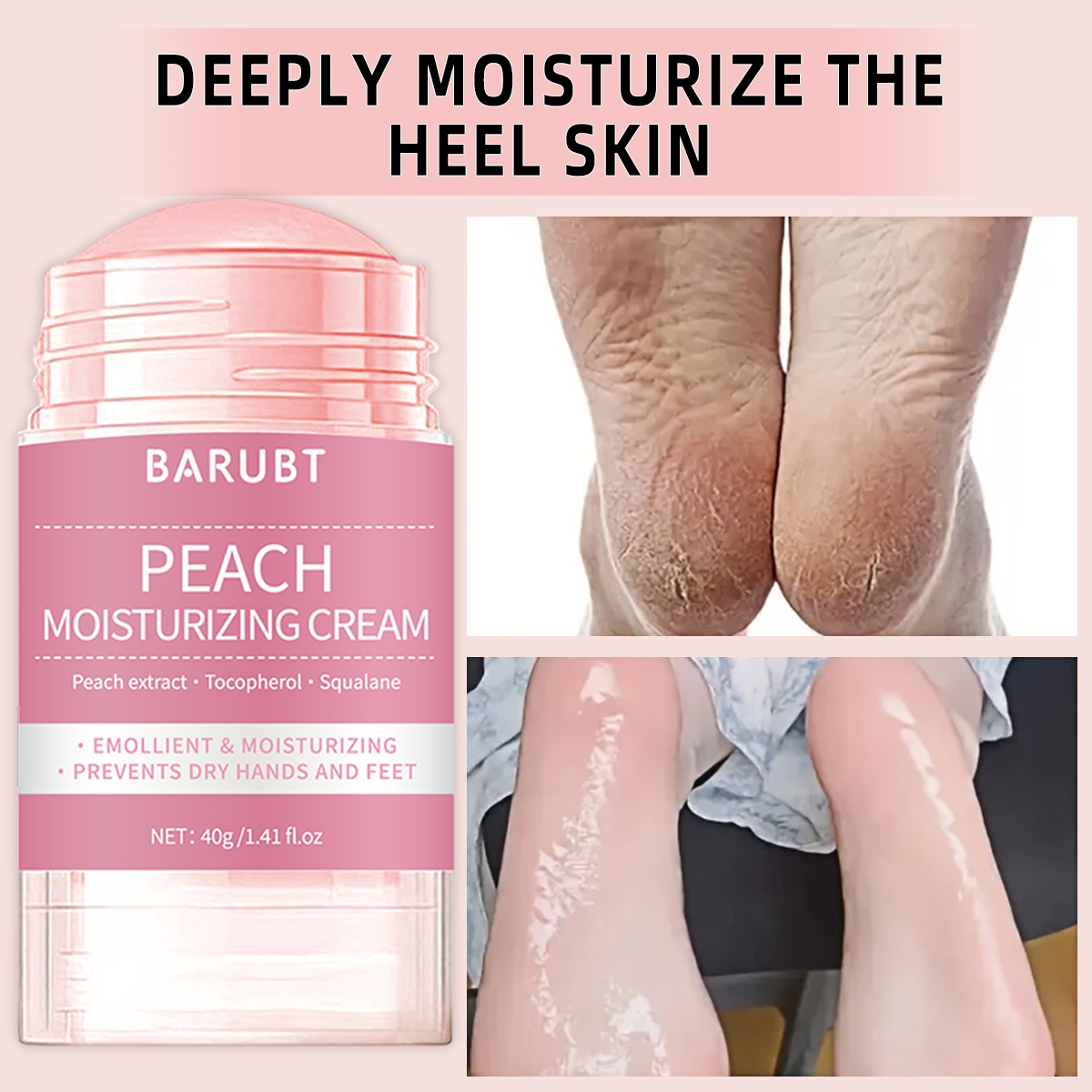 Peach urea mud film rod, salic - Azelaic Acid Cream reseña y precio