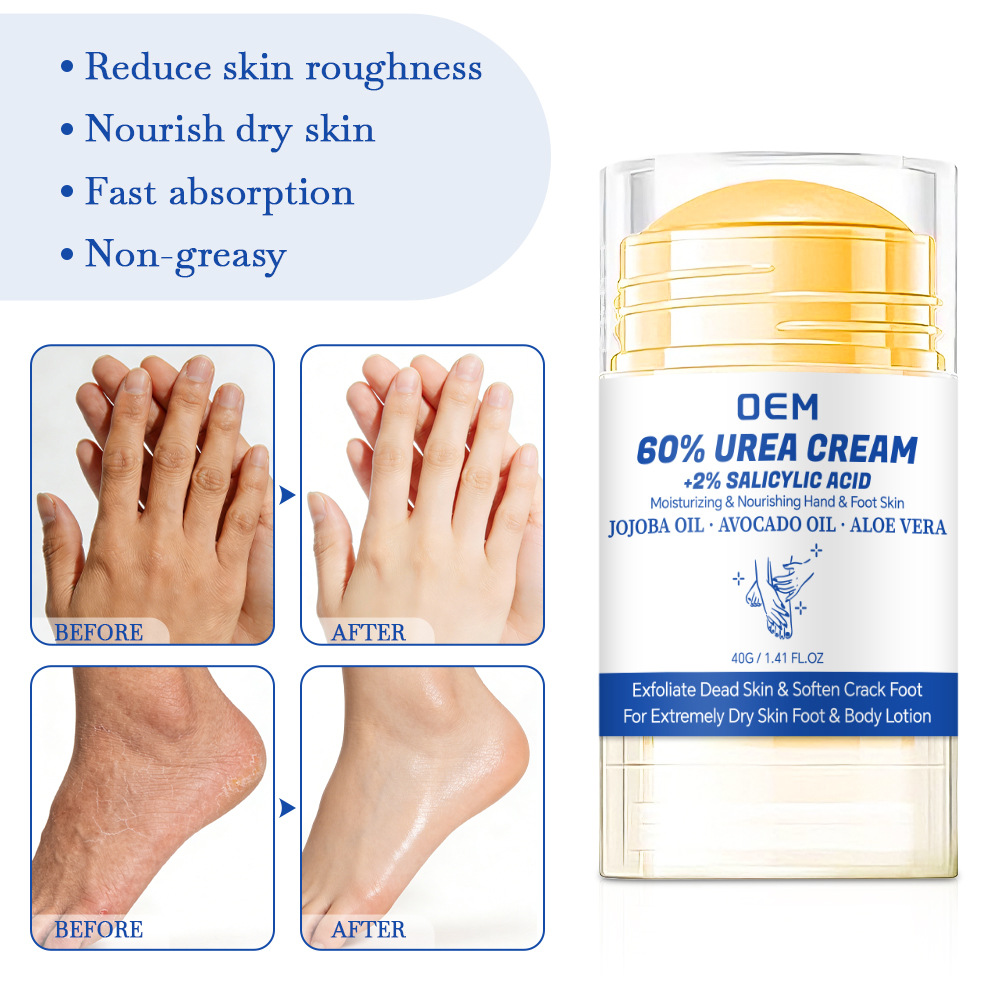60% Urea Foot Cream + 2% Salic - Azelaic Acid Cream reseña y precio
